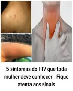 5 sintomas do HIV que toda mulher deve conhecer – Fique atenta aos sinais