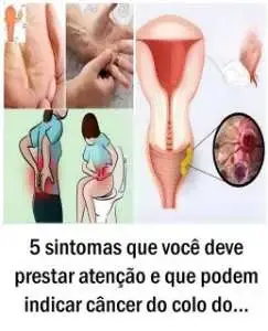 Câncer do colo do útero: 5 sinais que merecem atenção e a importância da prevenção