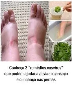 Conheça 3 “remédios caseiros” que podem ajudar a aliviar o cansaço e o inchaço nas pernas