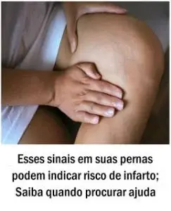Esses sinais em suas pernas podem indicar risco de infarto; Saiba quando procurar ajuda