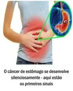 O câncer de estômago se desenvolve silenciosamente – aqui estão os primeiros sinais