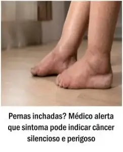 Pernas inchadas podem indicar a presença de câncer silencioso e letal; todo cuidado é pouco