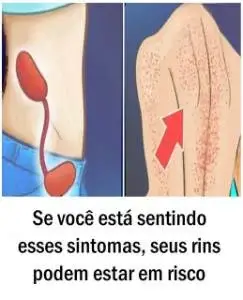 Se você está sentindo esses sintomas, seus rins podem estar em risco